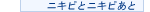 �j�L�r�ƃj�L�r����
