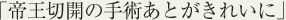 帝王切開の手術あとがきれいに