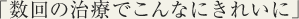 数回の治療でこんなにきれいに