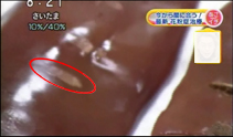 ミディアムレアの治療