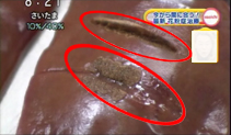 今までの花粉症治療